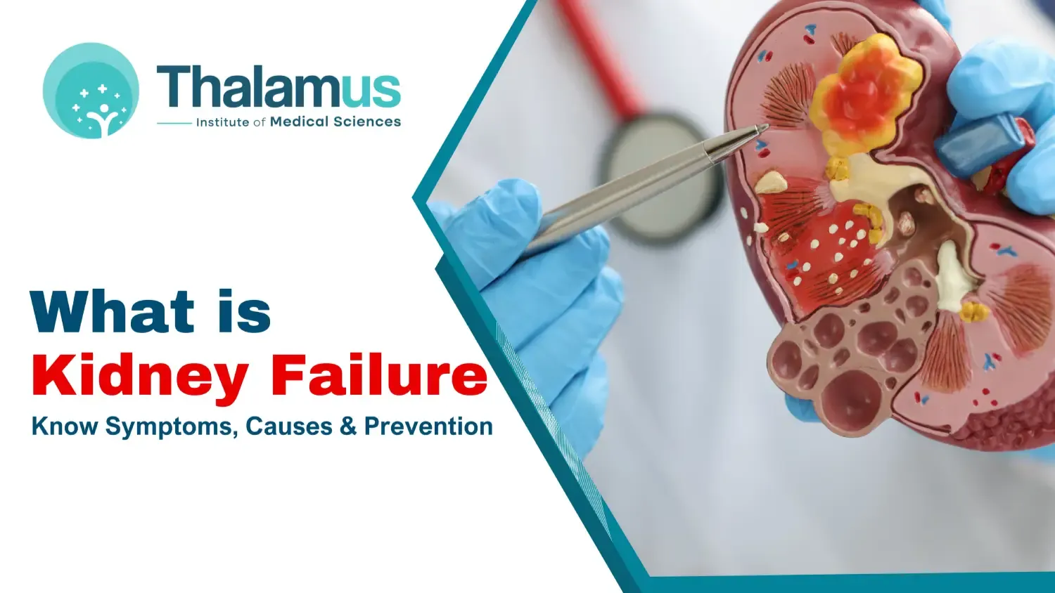 What is Kidney Failure? Know Symptoms, Causes & Prevention